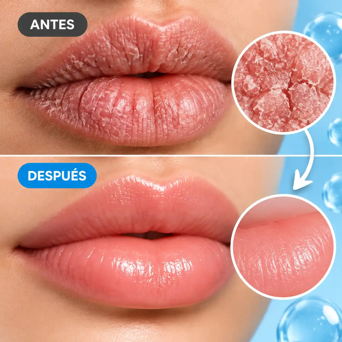 Belani Fordyce - Mejora la textura de tus labios.